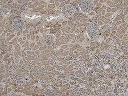 Invitrogen VPS25 Polyclonal Antibody 100 &mu;g; Unconjugated:Antibodies,