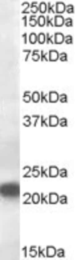 Invitrogen VPS25 Polyclonal Antibody 100 &mu;g; Unconjugated:Antibodies,