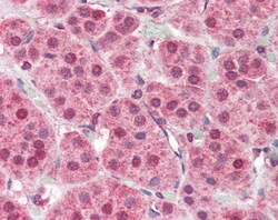 Invitrogen PARP2 Polyclonal Antibody 100 &mu;g; Unconjugated:Antibodies,
