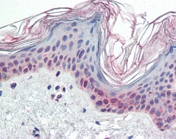 Invitrogen PARP2 Polyclonal Antibody 100 &mu;g; Unconjugated:Antibodies,