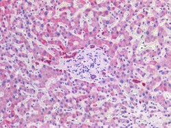 Invitrogen SCD Polyclonal Antibody 100 &mu;g; Unconjugated:Antibodies,
