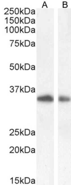 Invitrogen TIM3 Polyclonal Antibody 100 &mu;g | Buy Online | Invitrogen&trade; | Fisher Scientific