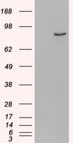 Invitrogen PDE4B Polyclonal Antibody 100 &mu;g; Unconjugated:Anticuerpos