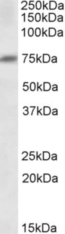 Invitrogen DCP1A Polyclonal Antibody 100 &mu;g; Unconjugated:Antibodies,