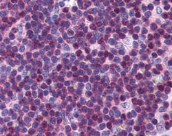 Invitrogen p27 Kip1 Polyclonal Antibody 100 &mu;g; Unconjugated:Antibodies,