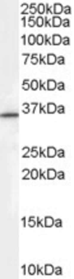 Invitrogen RNF115 Polyclonal Antibody 100 &mu;g; Unconjugated:Antibodies,