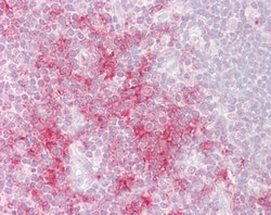 Invitrogen TRAF1 Polyclonal Antibody 100 &mu;g | Buy Online | Invitrogen&trade; | Fisher Scientific