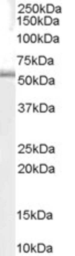 Invitrogen TRAF1 Polyclonal Antibody 100 &mu;g | Buy Online | Invitrogen&trade; | Fisher Scientific