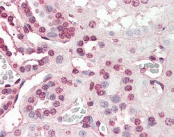 Invitrogen PIAS2 Polyclonal Antibody 100 &mu;g; Unconjugated:Antibodies,
