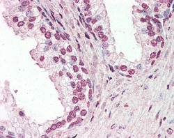 Invitrogen PIAS2 Polyclonal Antibody 100 &mu;g; Unconjugated:Antibodies,