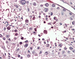 Invitrogen PIAS2 Polyclonal Antibody 100 &mu;g; Unconjugated:Antibodies,