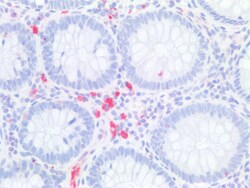 Invitrogen CDX2 Polyclonal Antibody 100 &mu;g | Buy Online | Invitrogen&trade; | Fisher Scientific