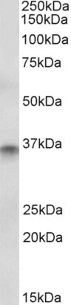 Invitrogen CDX2 Polyclonal Antibody 100 &mu;g | Buy Online | Invitrogen&trade; | Fisher Scientific