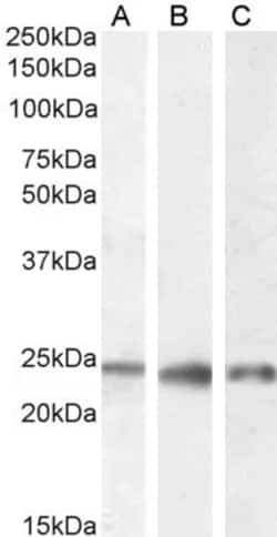 Invitrogen PGRMC1 Polyclonal Antibody 100 &mu;g; Unconjugated:Antibodies,