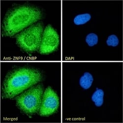 Invitrogen ZNF9 Polyclonal Antibody 100 &mu;g; Unconjugated:Antibodies,