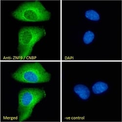 Invitrogen ZNF9 Polyclonal Antibody 100 &mu;g; Unconjugated:Antibodies,