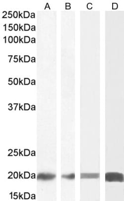 Invitrogen ZNF9 Polyclonal Antibody 100 &mu;g; Unconjugated:Antibodies,