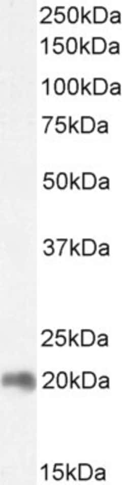 Invitrogen ZNF9 Polyclonal Antibody 100 &mu;g; Unconjugated:Antibodies,