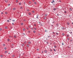Invitrogen EXOC7 Polyclonal Antibody 100 μg; Unconjugated:Antibodies,