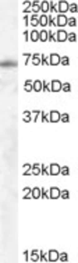 Invitrogen EXOC7 Polyclonal Antibody 100 μg; Unconjugated:Antibodies,