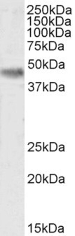 Invitrogen CK1 delta Polyclonal Antibody 100 &mu;g; Unconjugated:Antibodies,