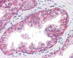 Invitrogen Catenin alpha-1 Polyclonal Antibody 100 &mu;g; Unconjugated:Antibodies,