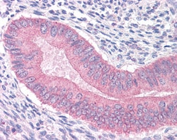 Invitrogen Catenin alpha-1 Polyclonal Antibody 100 &mu;g; Unconjugated:Antibodies,