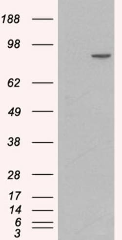 Invitrogen Catenin alpha-1 Polyclonal Antibody 100 &mu;g; Unconjugated:Antibodies,