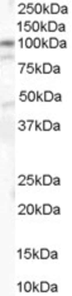 Invitrogen Catenin alpha-1 Polyclonal Antibody 100 &mu;g; Unconjugated:Antibodies,