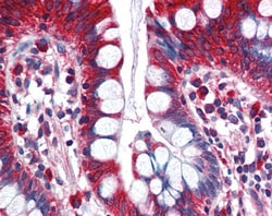 Invitrogen ACSL5 Polyclonal Antibody 100 &mu;g; Unconjugated:Antibodies,