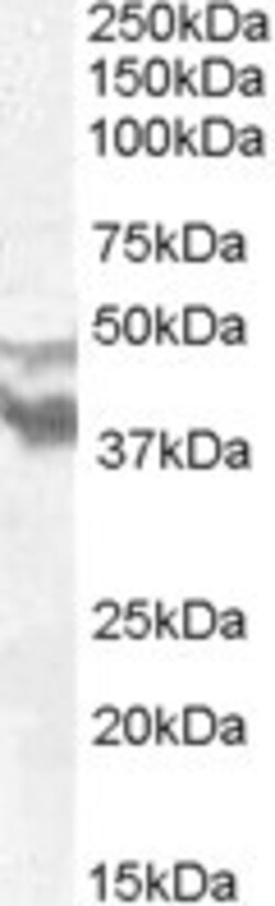 Invitrogen DYX1C1 Polyclonal Antibody 100 &mu;g; Unconjugated:Antibodies,