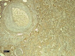Invitrogen Leptin Receptor Polyclonal Antibody 100 &mu;g; Unconjugated:Antibodies,