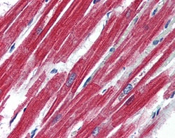 Invitrogen Leptin Receptor Polyclonal Antibody 100 &mu;g; Unconjugated:Antibodies,