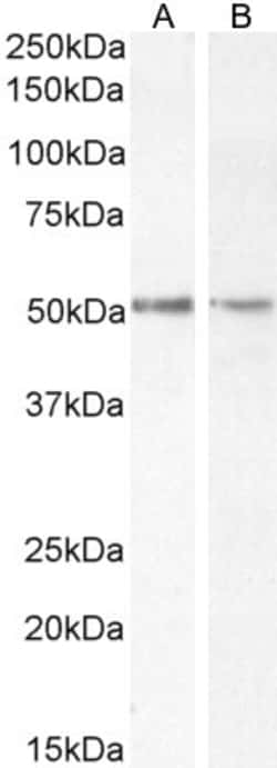 Invitrogen Chromogranin A Precursor Polyclonal Antibody 100 &mu;g; Unconjugated:Antibodies,
