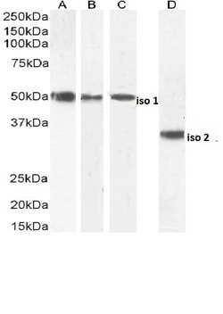 Invitrogen Chromogranin A Precursor Polyclonal Antibody 100 &mu;g; Unconjugated:Antibodies,