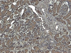 Invitrogen Catalase Polyclonal Antibody 100 &mu;g; Unconjugated:Antibodies,