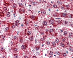 Invitrogen Catalase Polyclonal Antibody 100 &mu;g; Unconjugated:Antibodies,