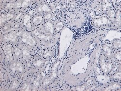 Invitrogen Catalase Polyclonal Antibody 100 &mu;g; Unconjugated:Antibodies,