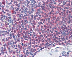 Invitrogen Catalase Polyclonal Antibody 100 &mu;g; Unconjugated:Antibodies,