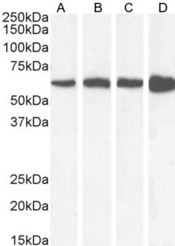 Invitrogen Catalase Polyclonal Antibody 100 &mu;g; Unconjugated:Antibodies,