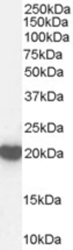 Invitrogen PRDX2 Polyclonal Antibody 100 &mu;g; Unconjugated:Anticuerpos