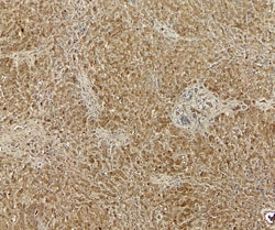 Invitrogen GRP94 Polyclonal Antibody 100 &mu;g; Unconjugated:Antibodies,