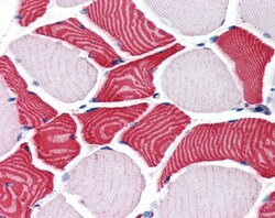 Invitrogen RCAS1 Polyclonal Antibody 100 &mu;g | Buy Online | Invitrogen&trade; | Fisher Scientific