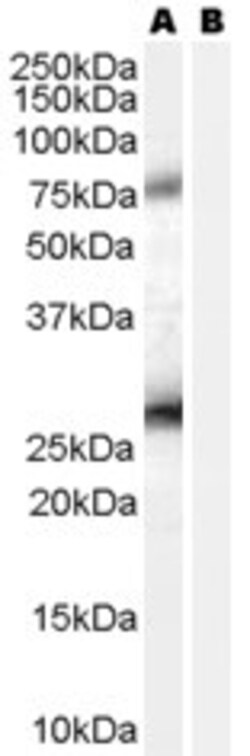 Invitrogen RCAS1 Polyclonal Antibody 100 &mu;g | Buy Online | Invitrogen&trade; | Fisher Scientific