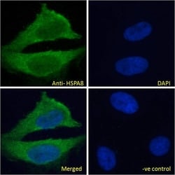 Invitrogen HSC70 Polyclonal Antibody 100 &mu;g | Buy Online | Invitrogen&trade; | Fisher Scientific