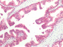 Invitrogen HSC70 Polyclonal Antibody 100 &mu;g | Buy Online | Invitrogen&trade; | Fisher Scientific