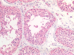 Invitrogen HSC70 Polyclonal Antibody 100 &mu;g | Buy Online | Invitrogen&trade; | Fisher Scientific