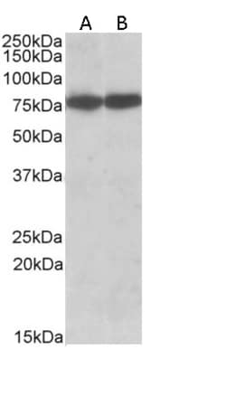 Invitrogen HSC70 Polyclonal Antibody 100 &mu;g | Buy Online | Invitrogen&trade; | Fisher Scientific