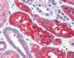 Invitrogen Ezrin Polyclonal Antibody 100 &mu;g | Buy Online | Invitrogen&trade; | Fisher Scientific