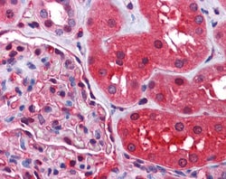 Invitrogen Radixin Polyclonal Antibody 100 &mu;g; Unconjugated:Antibodies,